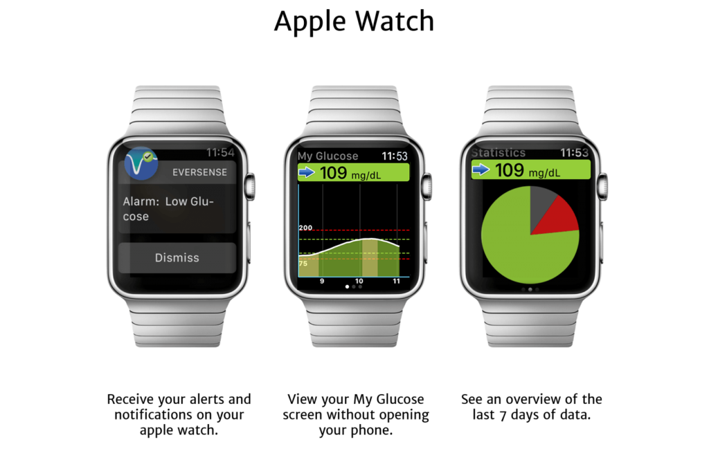 Aplikacja Eversense CGM dla Apple Watch